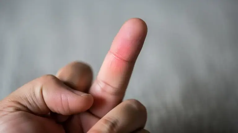 Dor na falange do dedo do meio